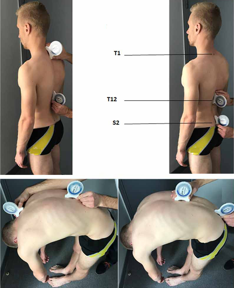 Use of inclinometers. Image from the article