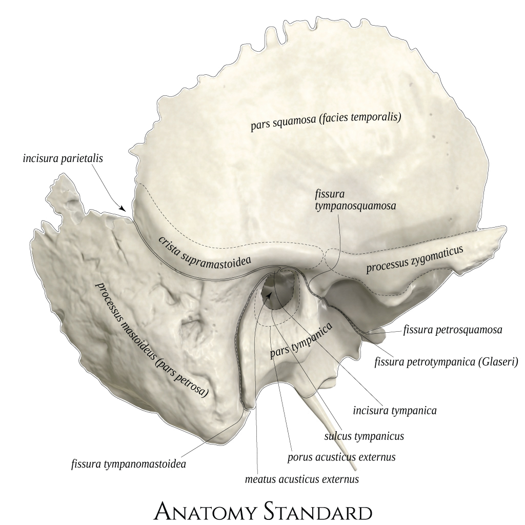 Temporal Bone Labeled Anatomy Temporal Bone Labeled Anatomy
